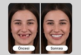 Vaka 1 öncesi ve sonrası