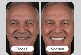 Vaka 3 öncesi ve sonrası